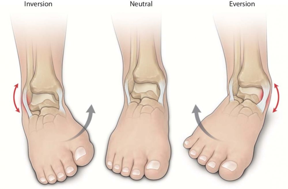 فشار بر روی مچ پا می تواند باعث شکستگی و یا رگ به رگ شدن مچ پا شود