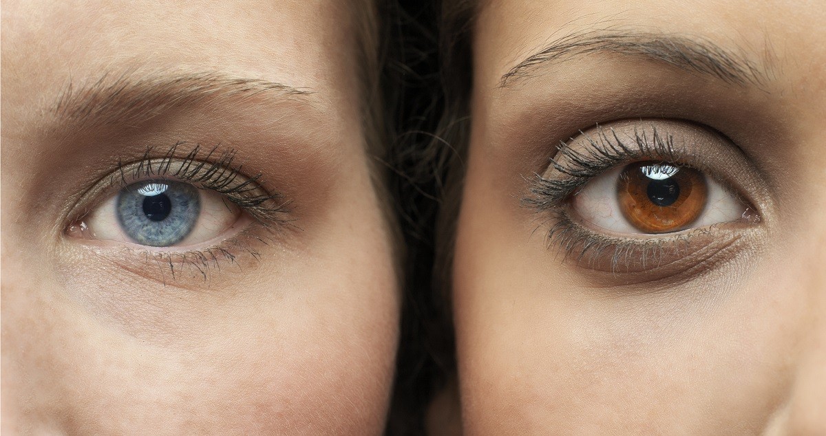 Eye Color Change Surgery - 