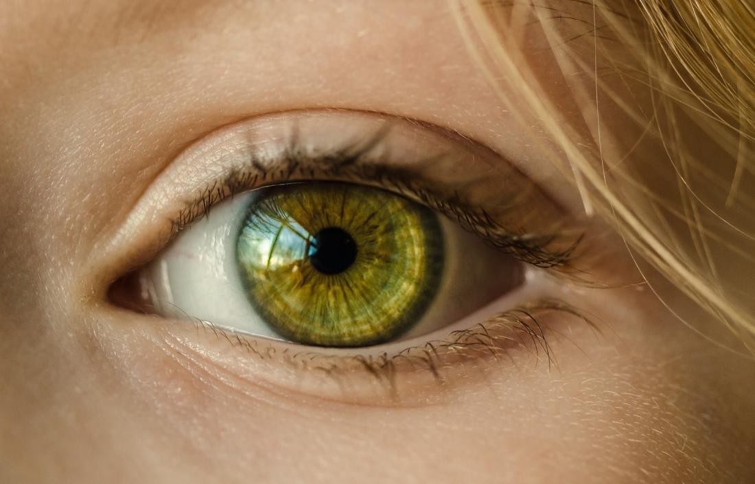 Eye Color Change Surgery - 